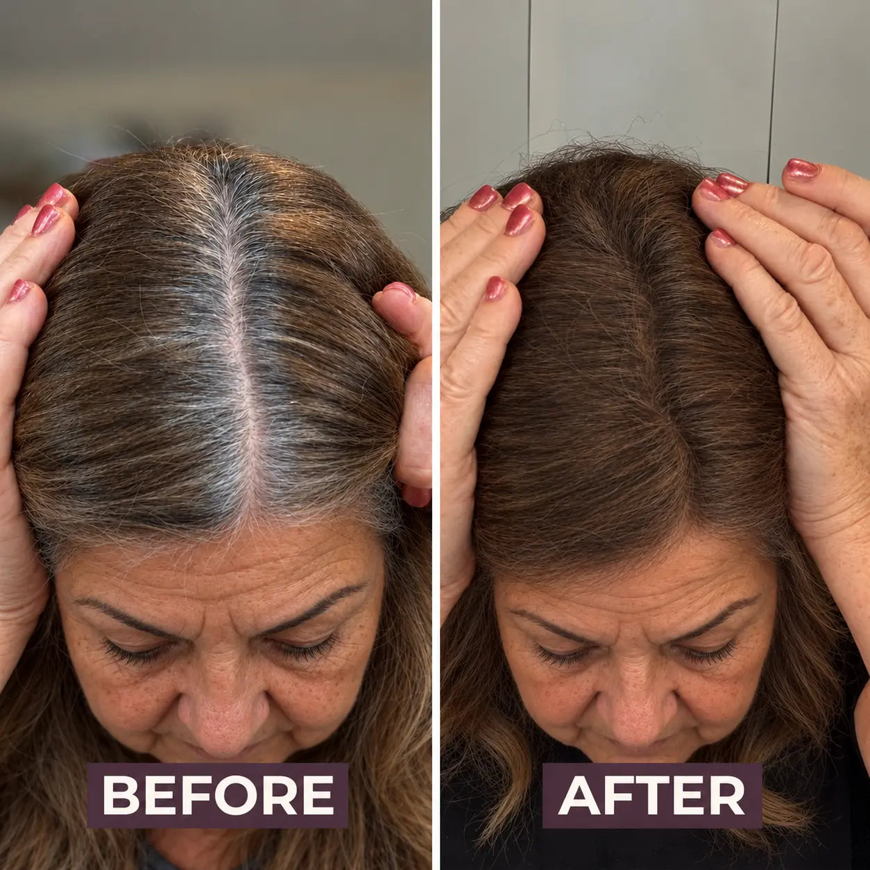 Retouvelle Hairline System