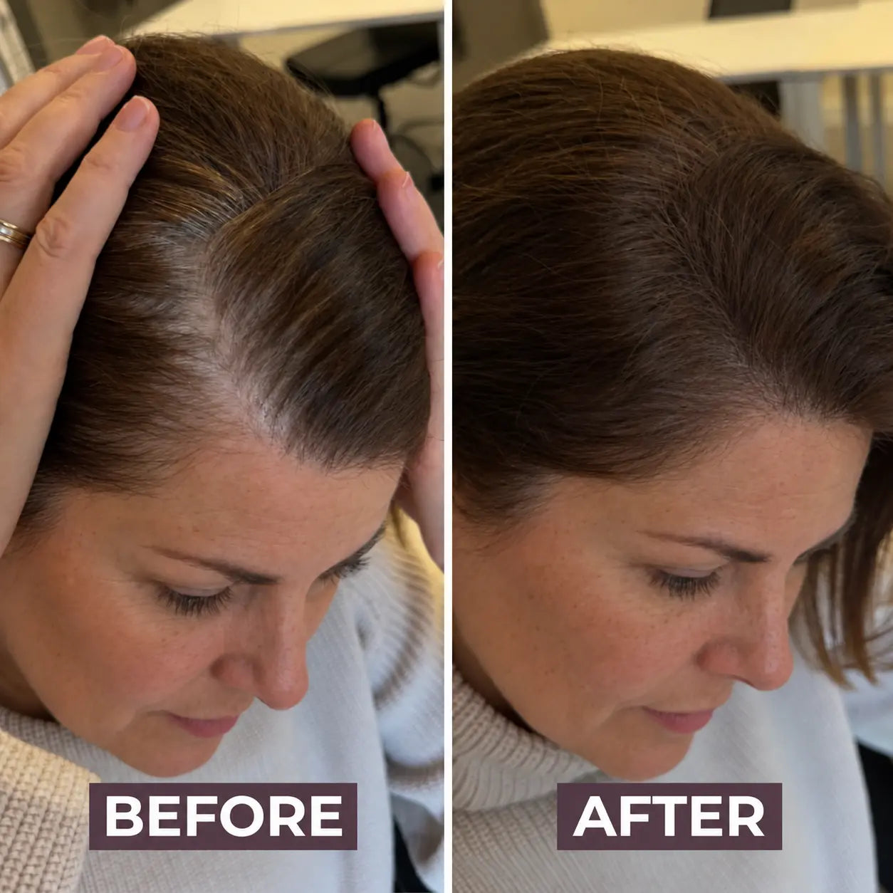 Retouvelle Hairline System